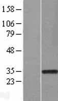 Human RAD1 Protein (Over-Expression Lysate Myc-DDK (Flag))