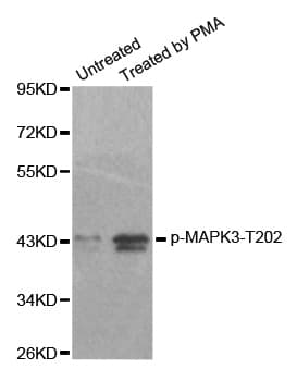 MAPK3 / ERK1 Antibody (phospho-Thr202)