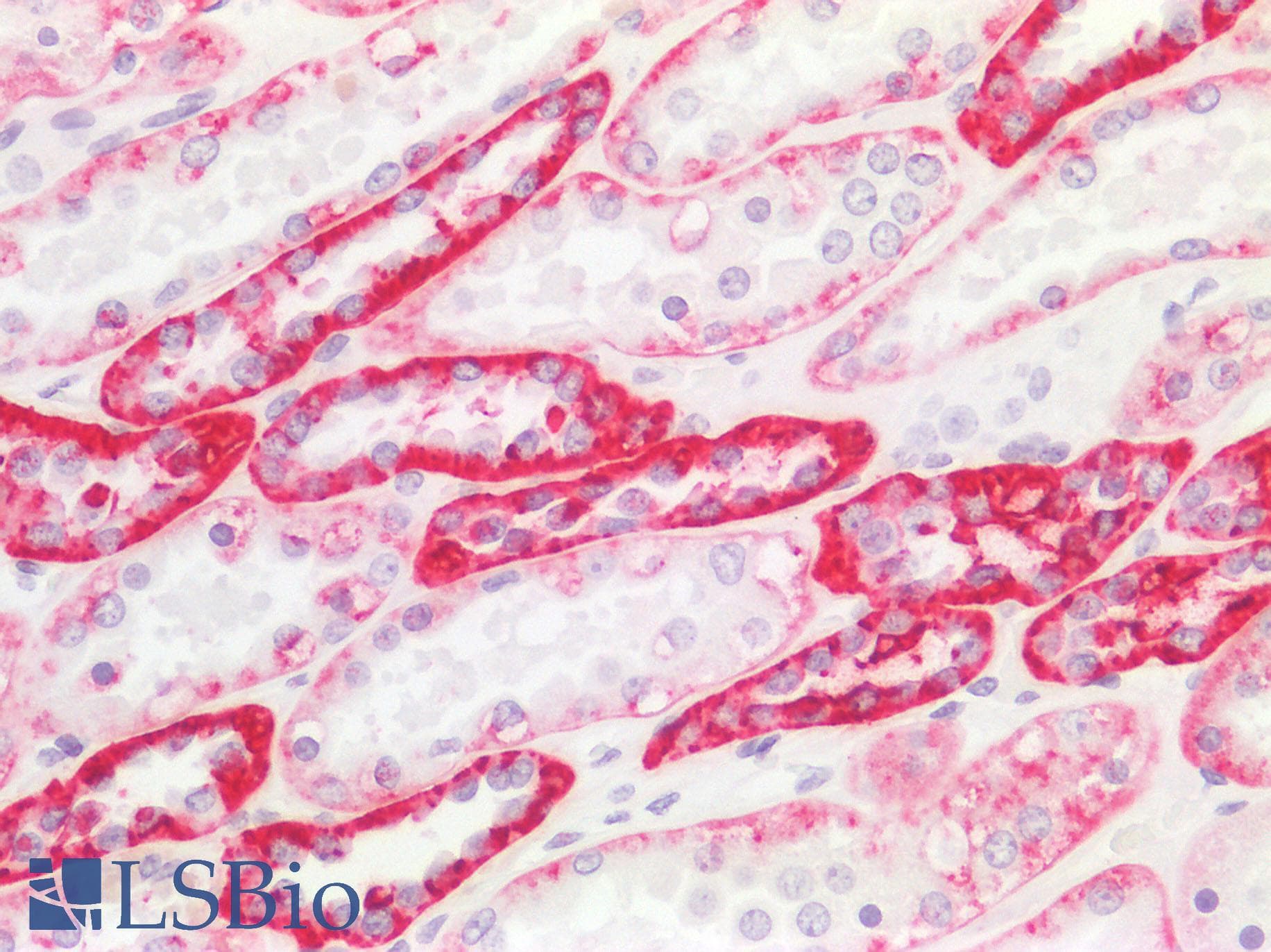 PathPlus™ Monoclonal Mouse anti-Human IL17A Antibody (clone 4K5F6, aa1-75, IHC, WB)