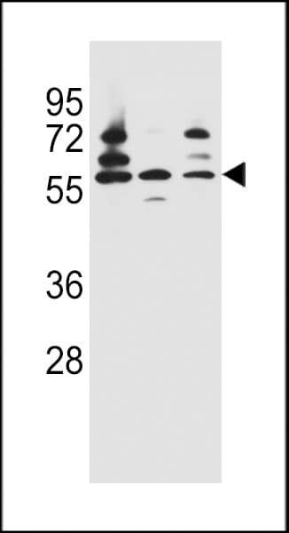 Polyclonal Rabbit anti-Human PDP1 Antibody (aa308-336, IHC, WB)