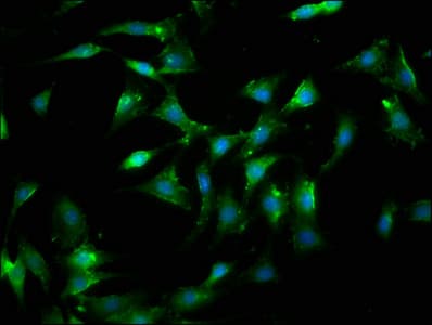 IHC-plus™ LGALS9 / Galectin 9 Antibody (aa1-323)