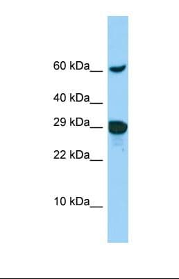 ADAMTSL1 Antibody (aa30-79)