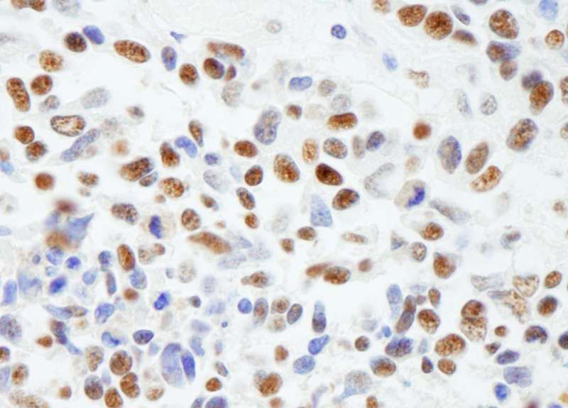 MTA1 Antibody (aa665-C-term)