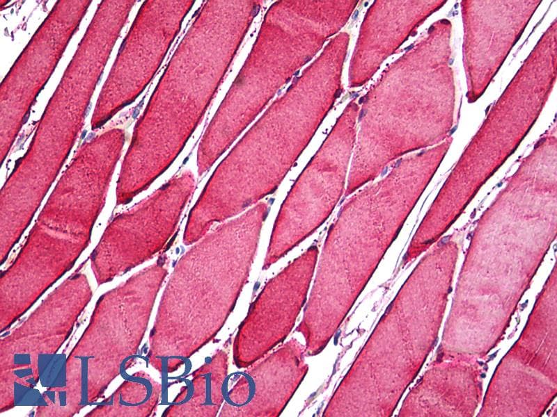 IHC-plus™ CA3 / Carbonic Anhydrase III Antibody (clone 4A12-1A3)