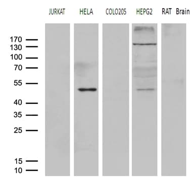 Monoclonal Mouse anti-Human AGPAT9 / MAG1 Antibody (clone OTI1D11, Carrier-free, aa41-131, IHC, WB)