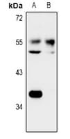 Polyclonal Rabbit anti-Human IOP1 / NARFL Antibody (IHC, WB)