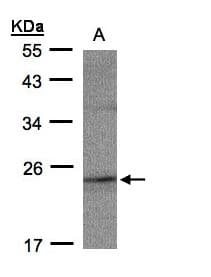 RAP2C Antibody (aa1-133)