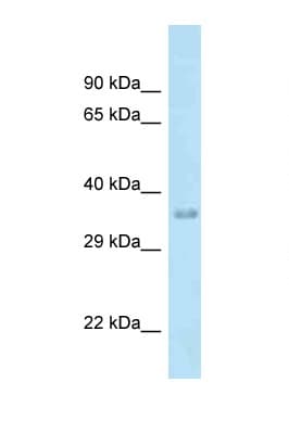Polyclonal Rabbit anti-Human MTFR1 Antibody (aa199-248, WB)