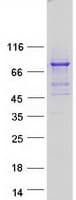 Human PPM1D / WIP1 Protein (Recombinant Myc-DDK (Flag))