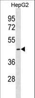 Polyclonal Rabbit anti-Human CTNS / Cystinosin Antibody (aa341-367, WB)
