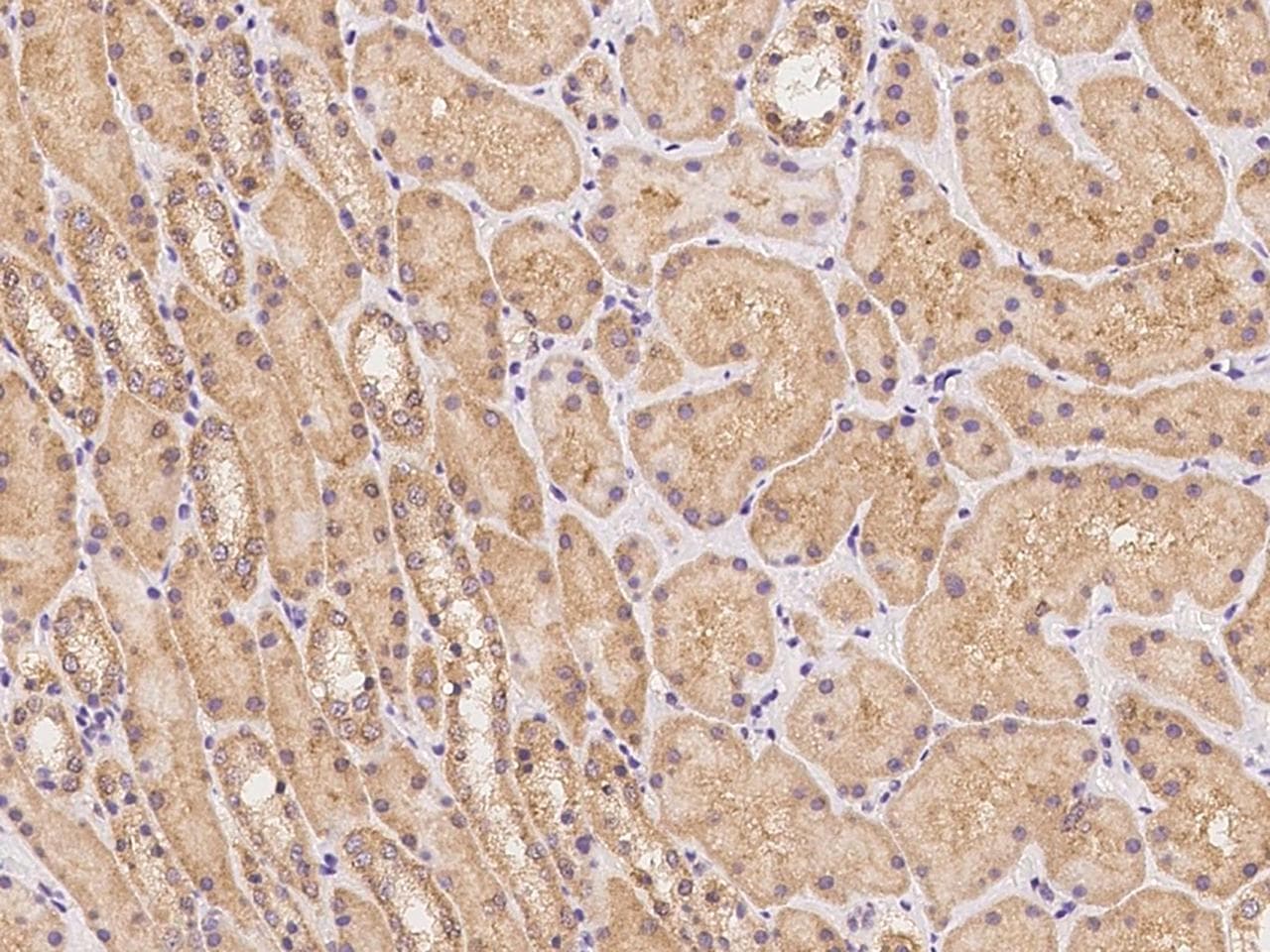 PLCL1 Antibody