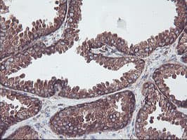 SULT1A1 / Sulfotransferase 1A1 Antibody (clone OTI5A1)