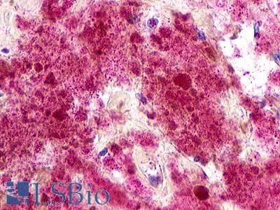 PathPlus™ Polyclonal Rabbit anti-Human ACKR2 / CCR10 / D6 Antibody (N-Terminus, IHC)