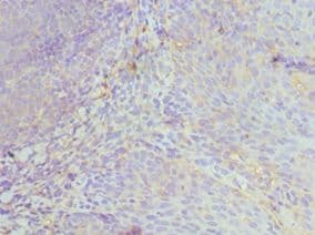 HCK Antibody (aa1-220)
