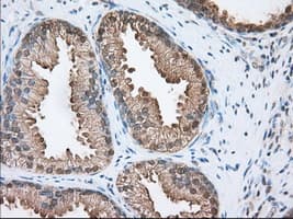 ACAT2 Antibody (clone OTI3E2)