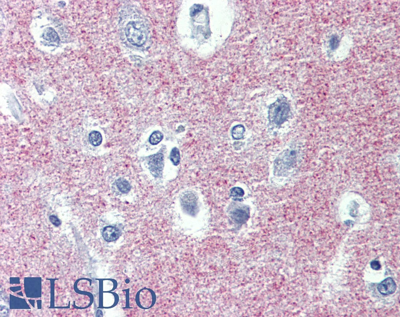 IHC-plus™ ADAM8 Antibody