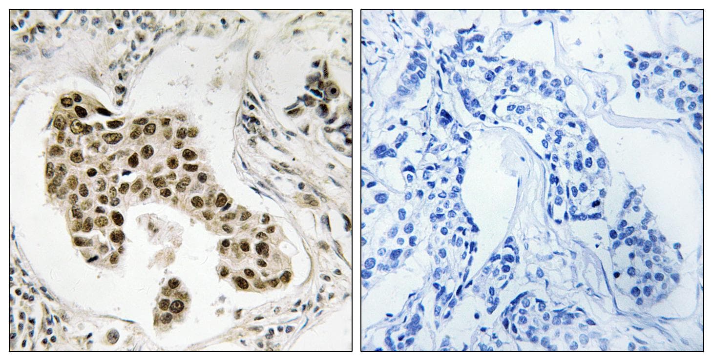 Polyclonal Rabbit anti-Human PMS2 Antibody (IHC, IF, WB)