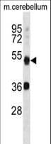 Polyclonal Rabbit anti-Human APG4B / ATG4B Antibody (aa16-45, IHC, WB)