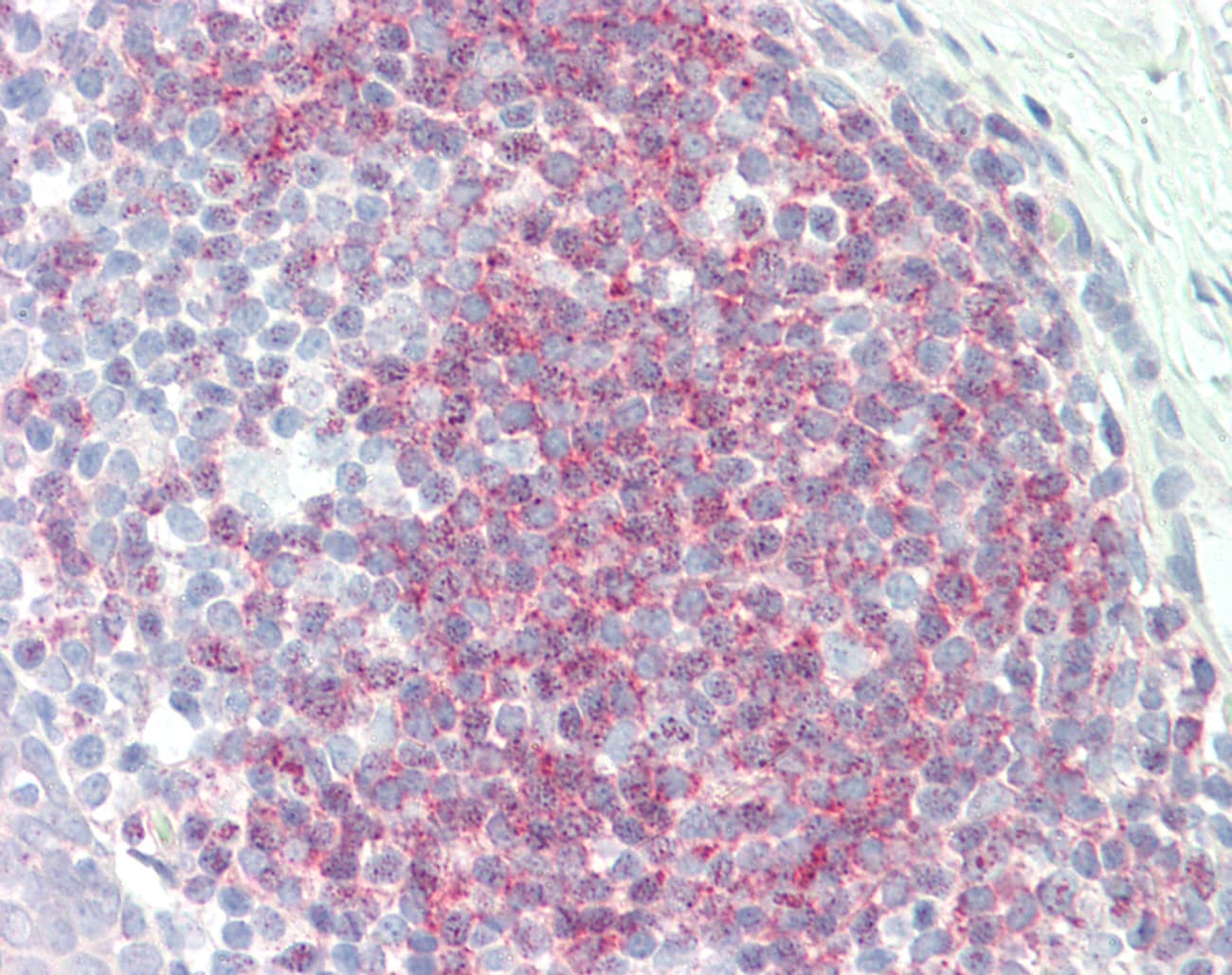 Polyclonal Rabbit anti-Human MRPS11 Antibody (aa113-162, IHC, WB)