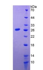 Human PRL / Prolactin Protein (Recombinant His-T7)