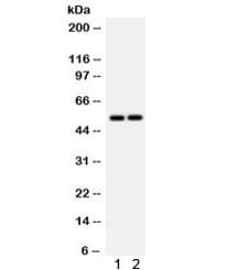 SCARB1 / SR-BI Antibody