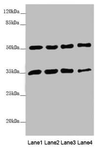 MTX1 / Metaxin 1 Antibody