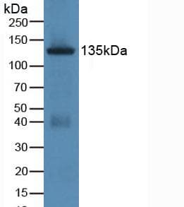 JAG1 / Jagged 1 Antibody (aa470-834)