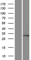RSPH9 / C6orf206 Protein (Over-Expression Lysate Myc-DDK (Flag))