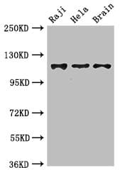 KIF11 / EG5 Antibody