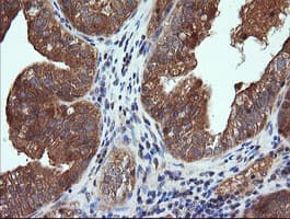 Monoclonal Mouse anti-Human CTAG1B / NY-ESO-1 Antibody (clone OTI5H4, IHC, IF, WB)