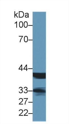LMAN2 / VIP36 Antibody (aa45-322, PE)