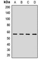 HMGCS1 / HMG-CoA Synthase 1 Antibody