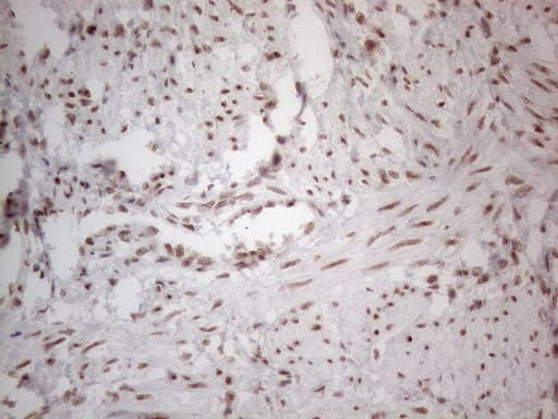 NR2C2 / TAK1 Antibody (aa1-241, clone OTI4B1)
