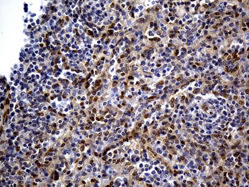 Monoclonal Mouse anti-Human WASL / N-WASP Antibody (clone OTI6A4, Carrier-free, IHC, WB)