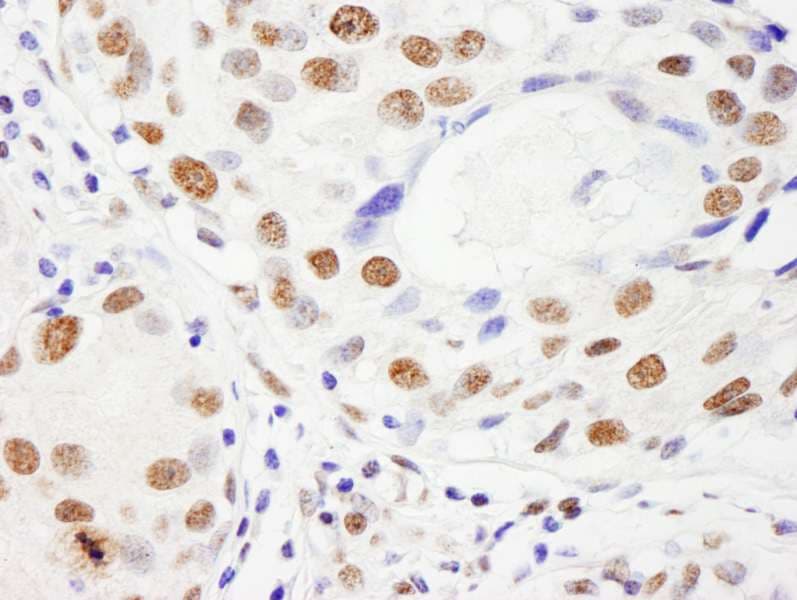 NUMA1 / NUMA Antibody (aa2065-2115)