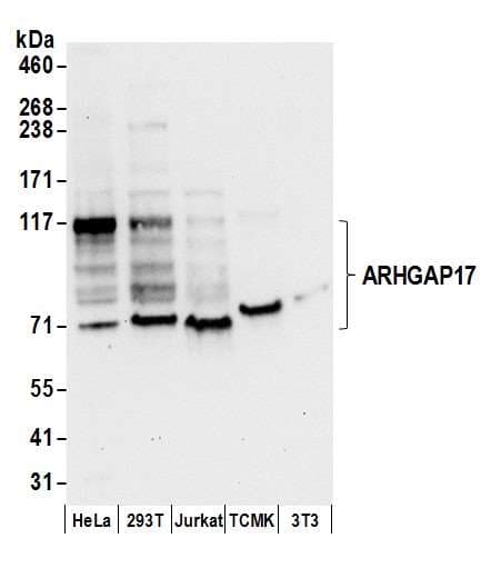 ARHGAP17 / NADRIN Antibody (aa757-625)
