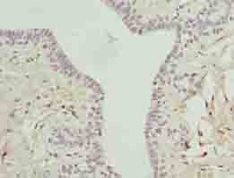ARMT1 Antibody
