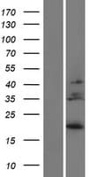 IL28B Protein (Over-Expression Lysate Myc-DDK (Flag))