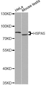 HSPA5 / GRP78 / BiP Antibody