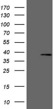 MED6 Antibody (clone OTI3B9)