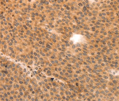 Polyclonal Rabbit anti-Human MLC2 / MYL9 Antibody (IHC, WB)