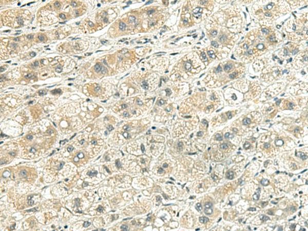 RHBDL2 / RRP2 Antibody