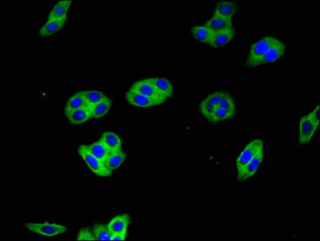 HRAS / H-Ras Antibody