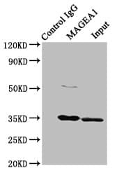 Polyclonal Rabbit anti-Human MAGEA1 / MAGE 1 Antibody (aa1-309, IHC)