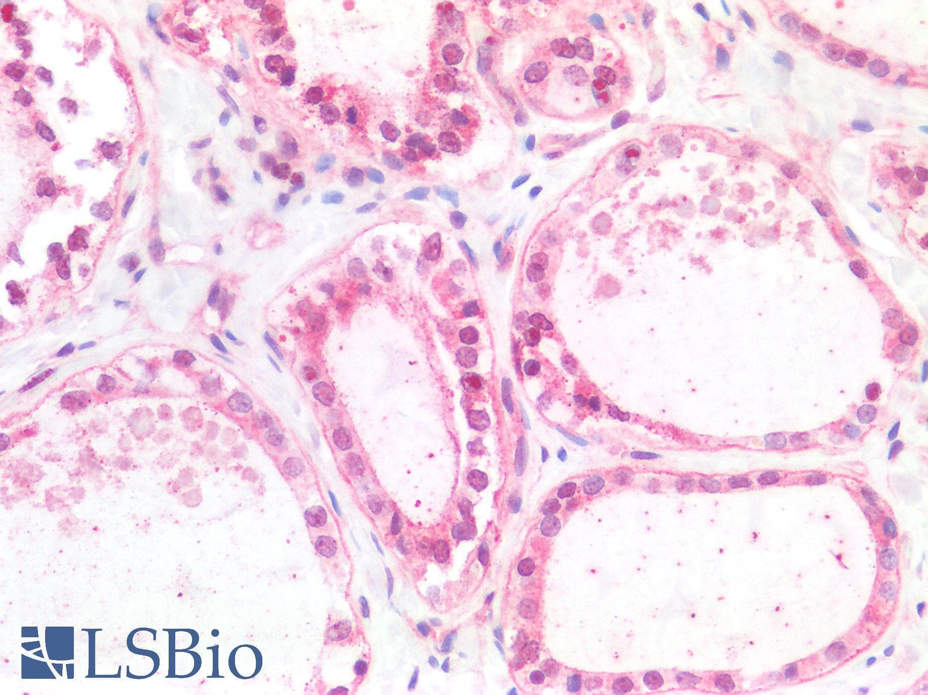 PathPlus™ p84 / THOC1 Antibody (aa1-404)
