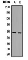 IKZF3 / AIOLOS Antibody (Internal)