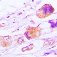 MRPL15 Antibody (Internal)