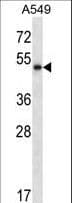 IHC-plus™ Polyclonal Rabbit anti-Human PNLIP / PL / Pancreatic Lipase Antibody (aa312-341, IHC, WB)