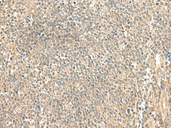 DAT1 / LMO3 Antibody