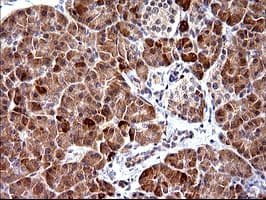 Monoclonal Mouse anti-Human PLA2G16 / HRASLS3 Antibody (clone OTI1A5, IHC, IF, WB)